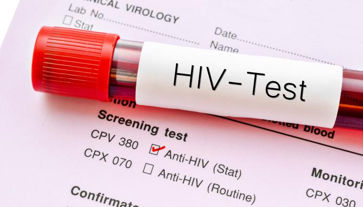 ХИВ - Болните от ХИВ са се увеличили през миналата година!
