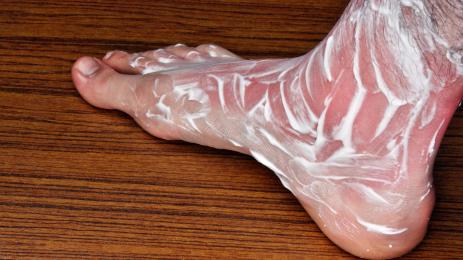 кисело мляко изгаряне