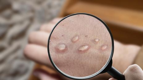 маймунска шарка