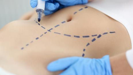 кожа операция