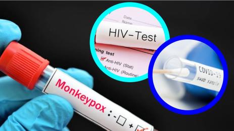 маймунска шарка коронавирус спин