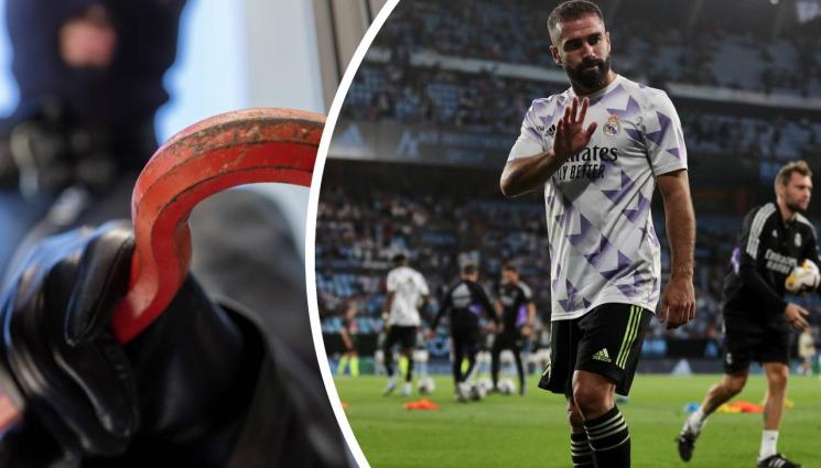 Карвахал - Оперираха успешно Дани Карвахал