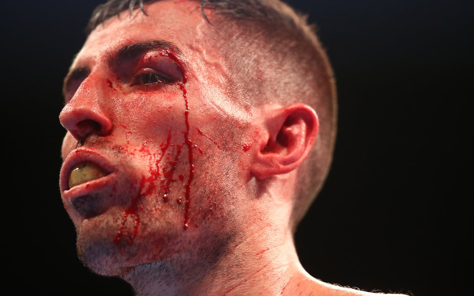   Шампионът в категория муха на IBF Съни Едуърдс ще