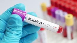 Норовирус е причинителят на стомашните проблеми на учениците от Спортното