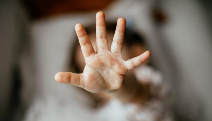 бой - ЖЕСТОКОСТ: Почти 2-годишно дете е в кома след безмилостен побой от майката