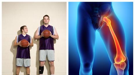 нисък мъж бедрена кост