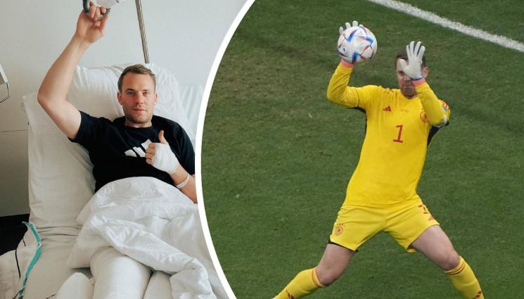 Нойер - Нойер счупи крак на ски