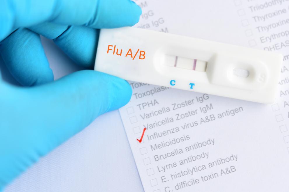 Най-много са регистрираните пациенти съссвински грип у нас, следвани от