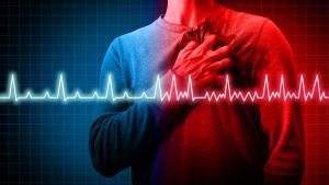 Инфарктите сред младите хора зачестяват съобщи ЮПИ Според данните инфарктите