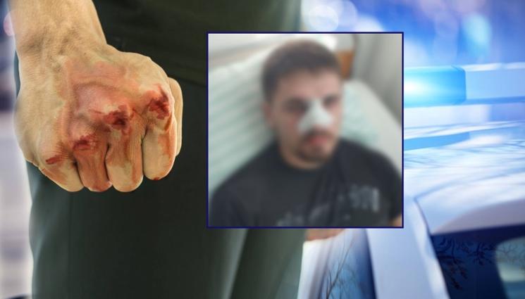 бой момче плевен дискотека - Бащата на пребитото от униформени момче: Полицаите са празнували в заведение, започнали директно да бият при спор между младежите