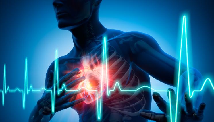 инфаркт сърце