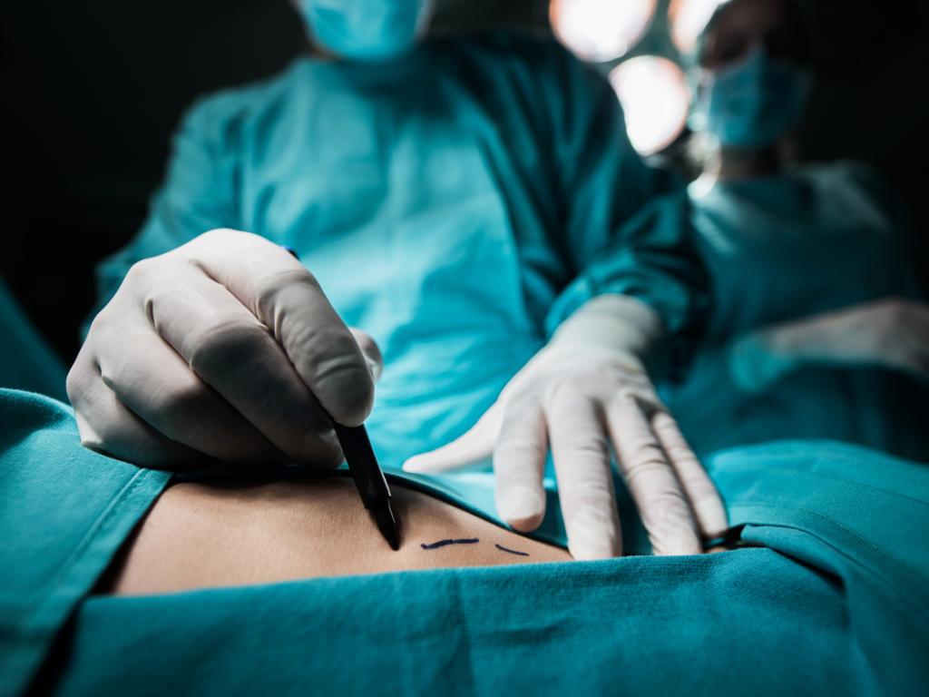 Бивш хирург извършващ бъбречни трансплантации бил порицан и отстранен от