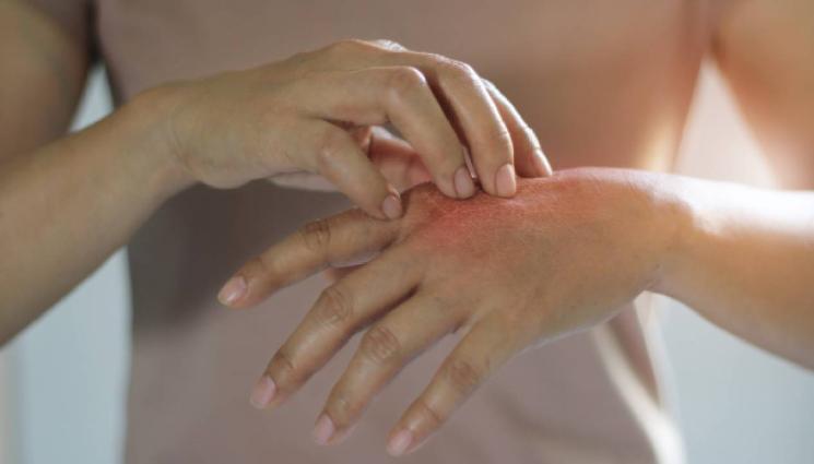 златно време - ЗЛАТНО ВРЕМЕ: 7 болести, които могат да се видят по ръката