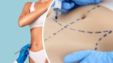 липосукция