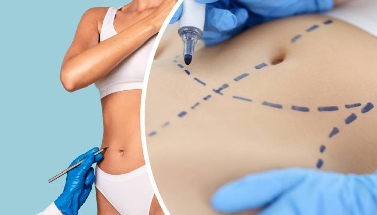 липосукция - УБИЙСТВЕНА КРАСОТА: Млада майка почина след липосукция в мол