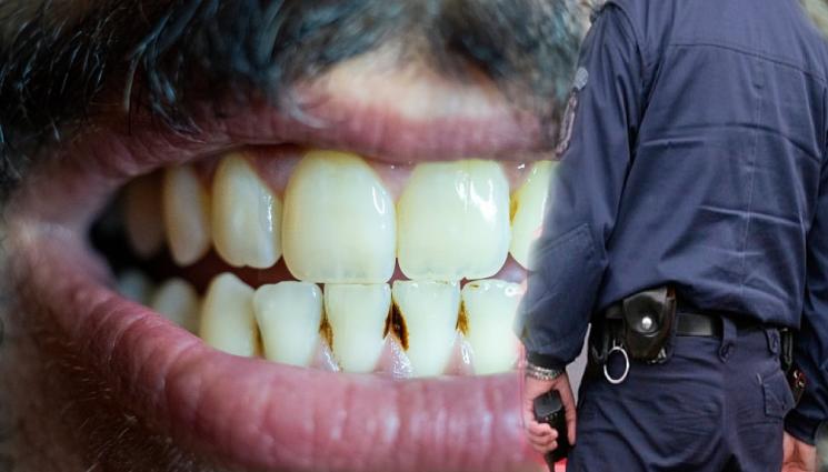 а - ОГОЛИ ЗЪБИ: 21-годишен захапа ченге по крака, бранел като питбул мацката си от проверка!