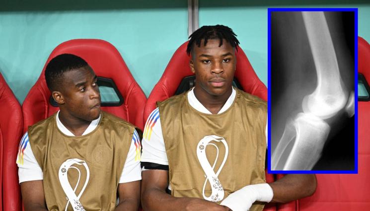 измама възраст футболисти - ИНТЕРЕСНО: Как се проверява възрастта на футболистите?