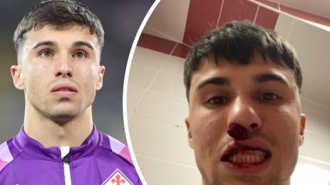 Бианко Фиорентина Сивасспор