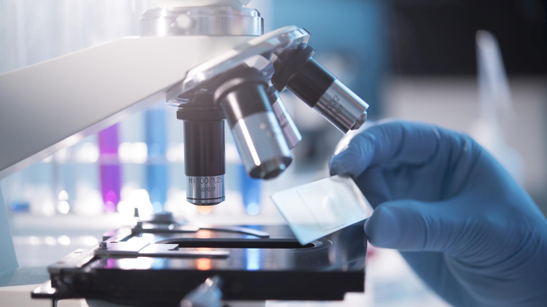 Има леко увеличаване на заболеваемостта от COVID 19 но тя е