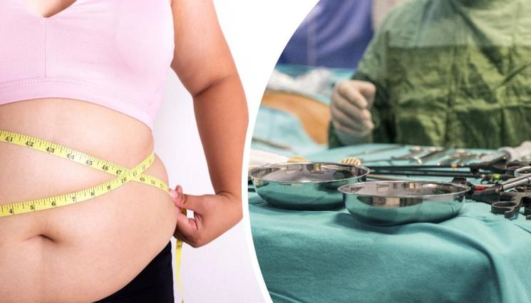a - БИ БИ СИ: Дебели британци умират след операции за отслабване в Турция, други падат тежко увредени след интервенциите