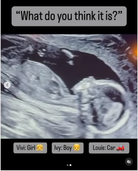 Хари Кейн Инстаграм бебе