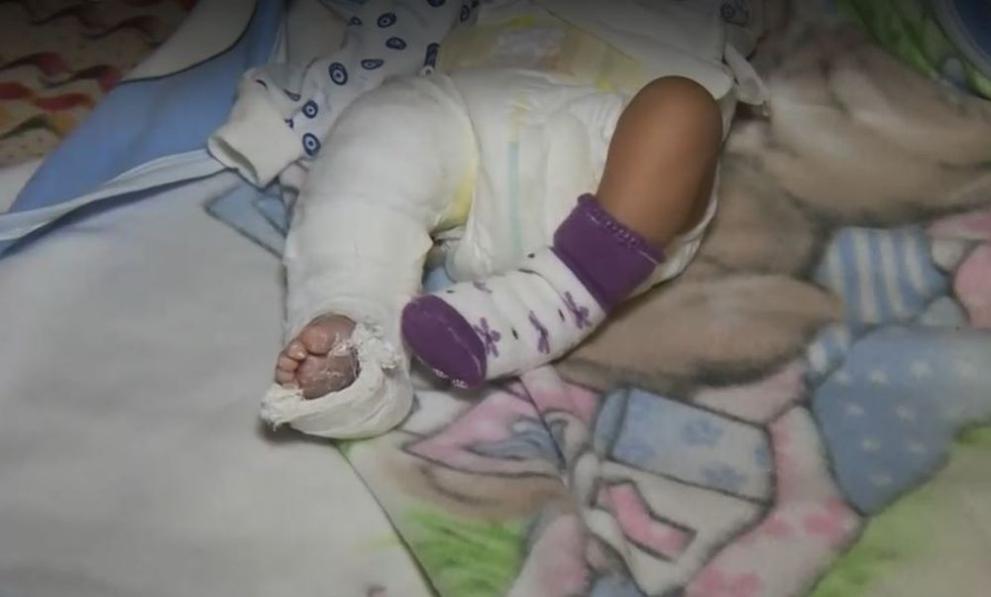 Родители на новородено твърдят, че детето им е пострадало по