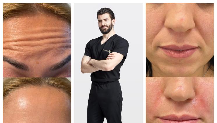 Симеон Личев - Хидратираме кожата с мезотерапии и скинбустер