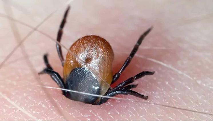 кърлеж - ЗЛАТНО ВРЕМЕ: Как да разберем, че ни е гризнал кърлеж