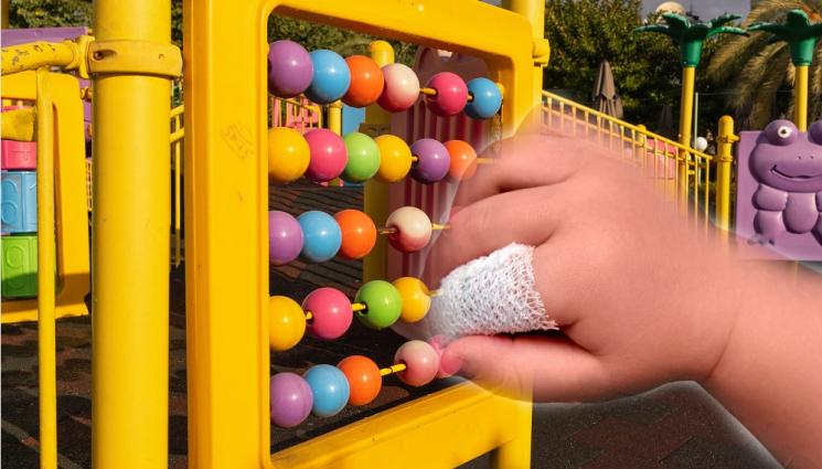 дете пръст - УЖАСЯВАЩ ИНЦИДЕНТ: Дете на 1 годинка с премазан пръст след игра на площадка