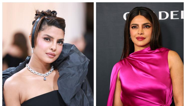 Прянка Чопра - ПРОПЛАКА: Прянка Чопра обезобразена след пластична операция