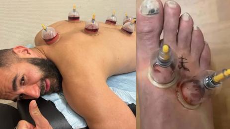 Бензема вендузи