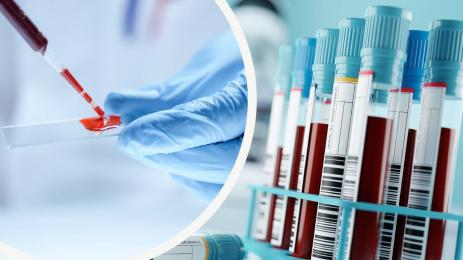 кръвен тест кръв