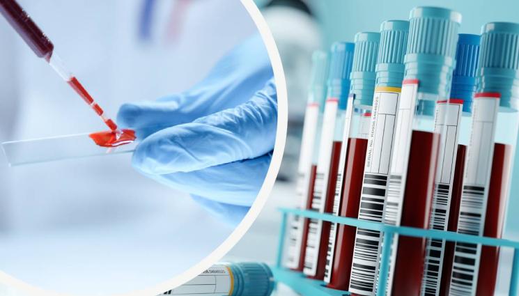 кръвен тест кръв