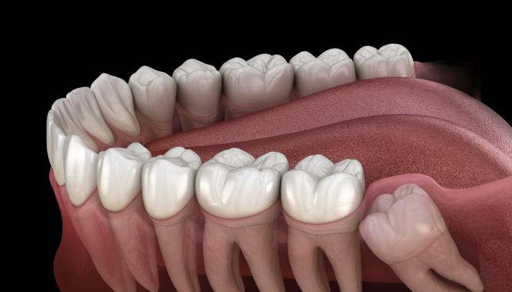 мъдрец зъби - ЗЛАТНО ВРЕМЕ: Трябват ли ни мъдреци?