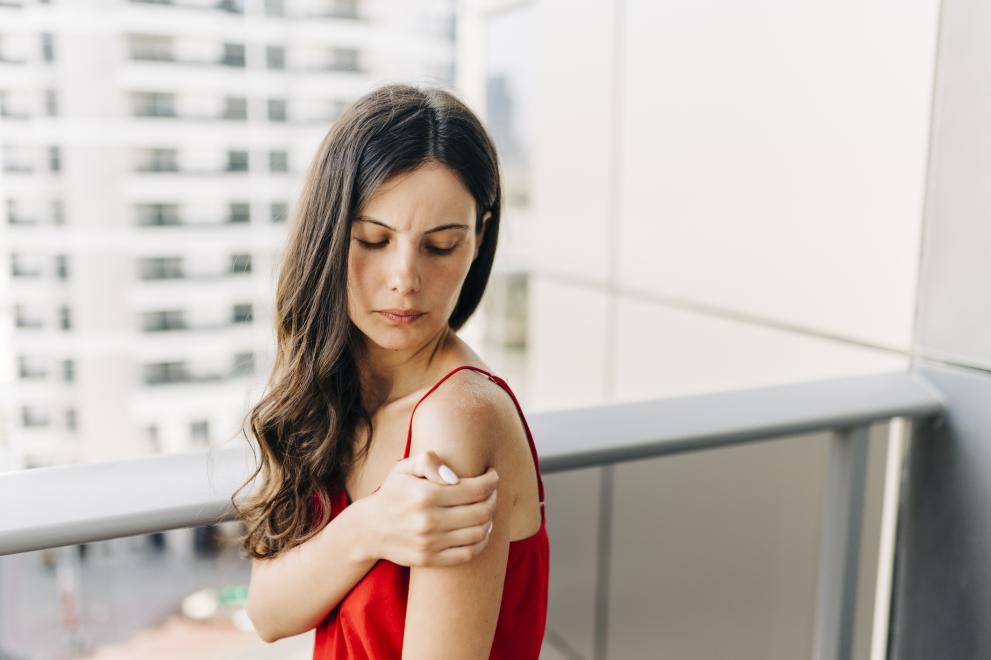 Слънчевата алергия е реакция на кожата на някои хора към