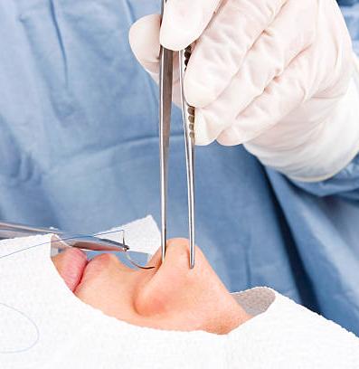 ринопластика