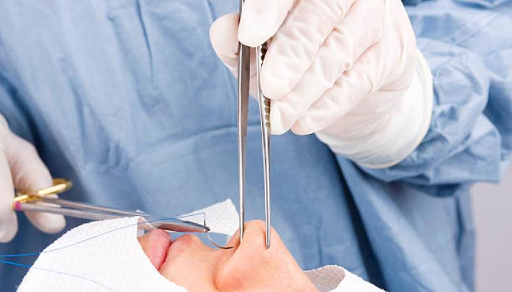 ринопластика - ЖЕСТОКА ТРАГЕДИЯ: Моделка си клъцна носа, изпадна в кома! (СНИМКА)