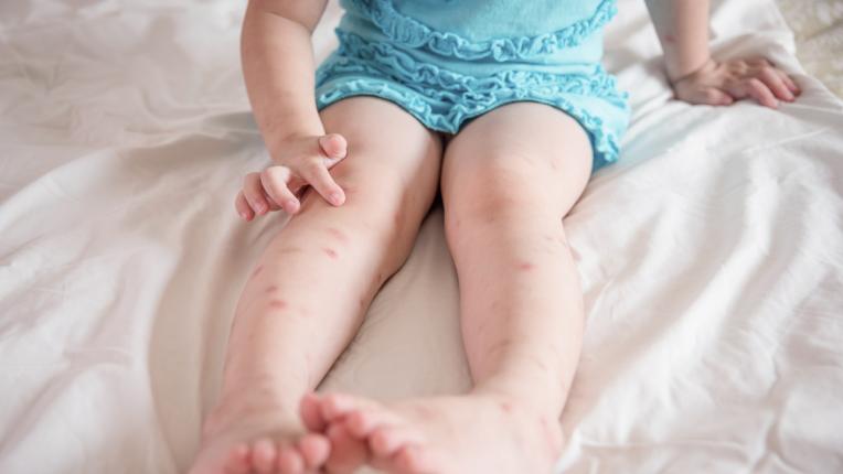 Домашни рецепти за репеленти срещу комари