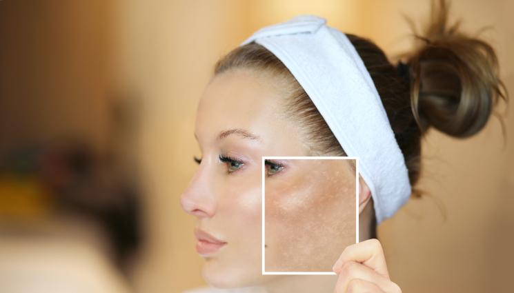 кожа - БГ учени създадоха човешка кожа