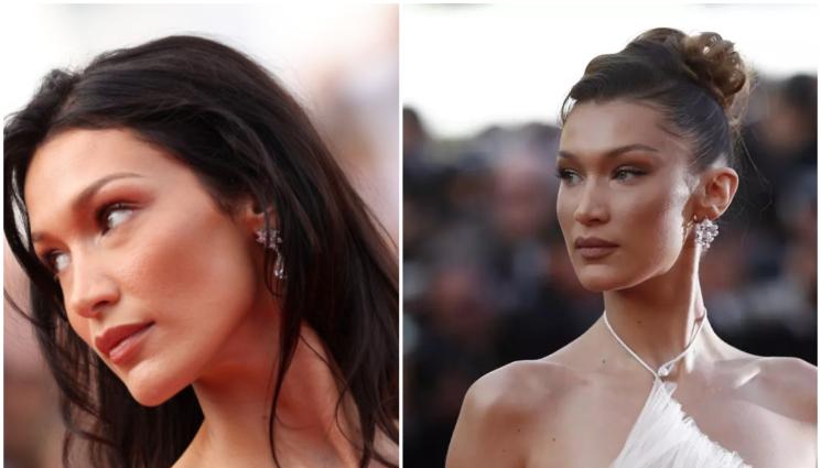 Бела - ЗАГАЗИ ГО: Страшна болест мъчи Бела Хадид