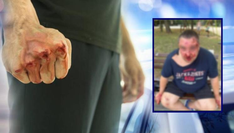 q - ЖЕСТОКА АГРЕСИЯ В ПАРКА! Пребиха баща пред очите на детето му