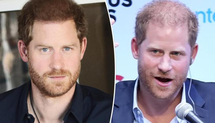 хари - ЗАРАДИ ДОКУМЕНТИТЕ ЗА ВИЗА: Заподозряха принц Хари, че страда от венерическа болест!