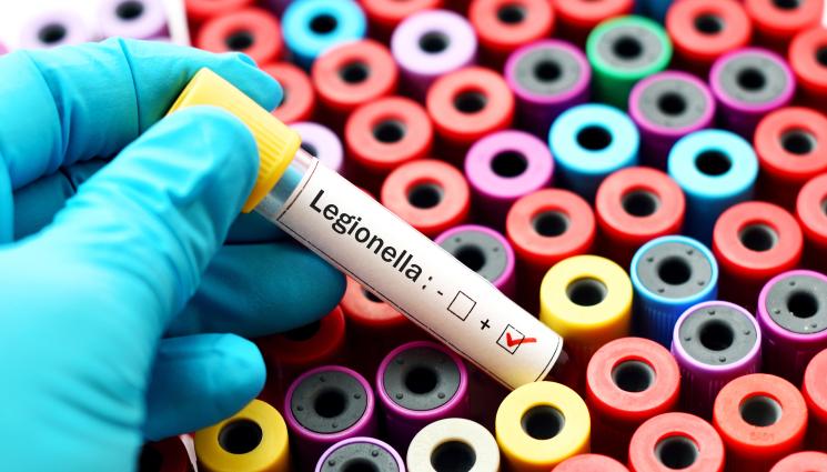 легионерска болест - ИСТИНСКИ АД: Избухна епидемия от легинонерска болест, петима души загинаха!