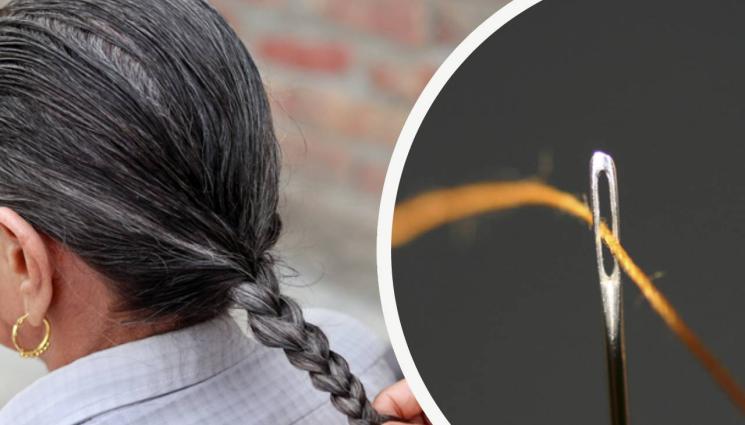 игла глава - ШОК! Откриха 3-сантиметрова игла в главата на баба