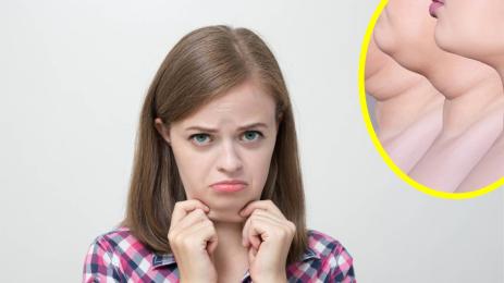 Двойна брадичка