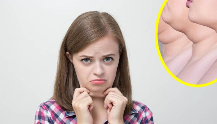 Двойна брадичка - Двойната брадичка – риск на професията