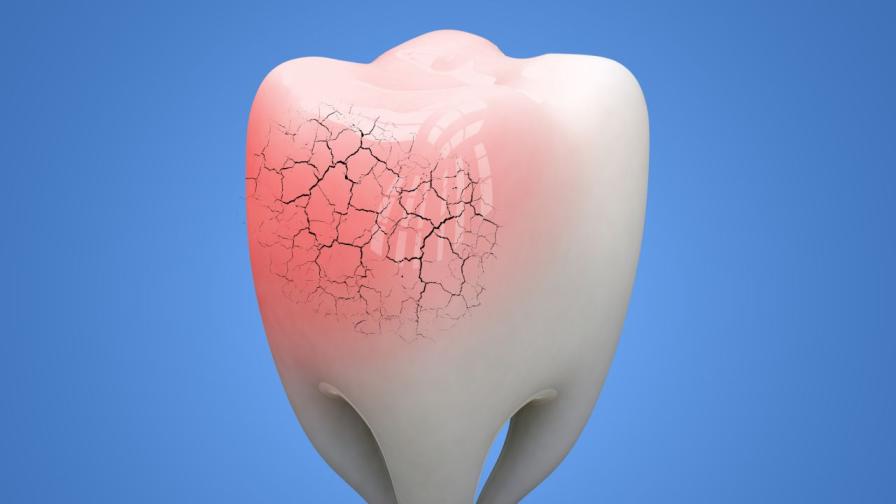 Скритите причини за увреждане на зъбния емайл: от избелващи пасти до дъвчене на лед