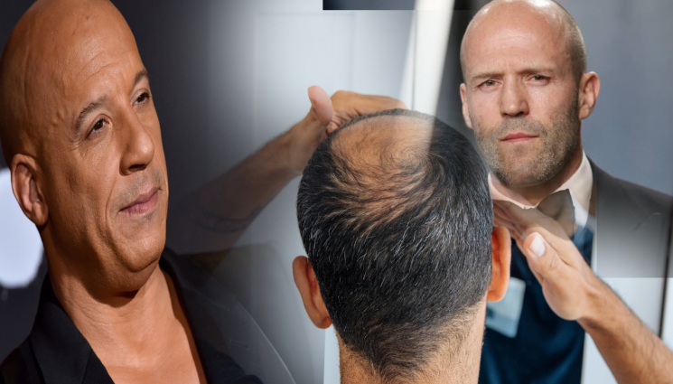 плешив - КОЙ СЕГА Е НОМЕР 1? Избраха най-секси плешивец в света