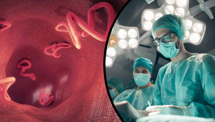 червеи - ОТВРАТИТЕЛНО: Извадиха 60 живи червея от окото на жена