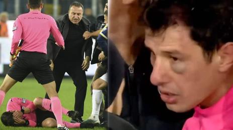 Анкарагюджю побой рефер